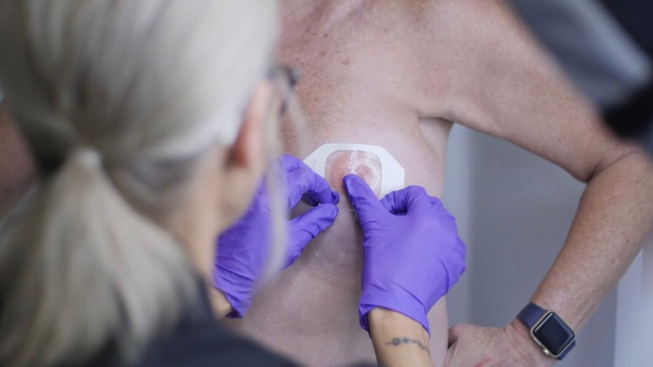 A doctor performing an areola restoration derma micro pigmentation service. She is color matching a patient's nipple.